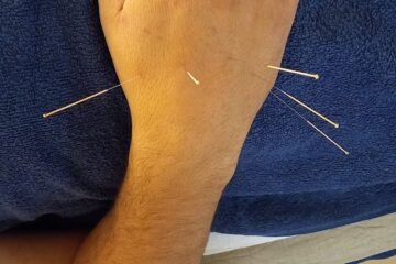 Alcoutim Acupuntura & Massagem / RS Acupuncture-Acupunturista