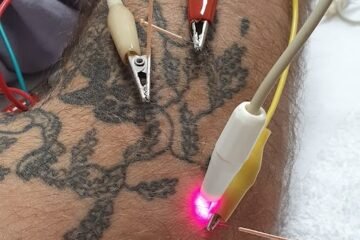 Saches Cardoso Pain Therapy Center | Acupuncture & Massage-Terapeuta de medicina alternativa