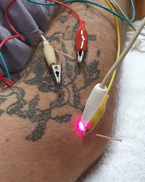 Saches Cardoso Pain Therapy Center | Acupuncture & Massage-Terapeuta de medicina alternativa