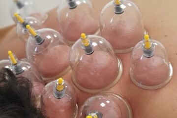 Saches Cardoso Pain Therapy Center | Acupuncture & Massage-Terapeuta de medicina alternativa