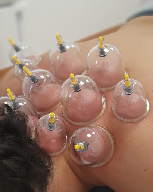 Saches Cardoso Pain Therapy Center | Acupuncture & Massage-Terapeuta de medicina alternativa