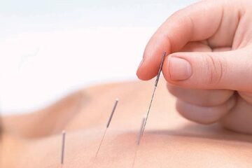 Terapia Ki Mek Acupuntura-Acupunturista