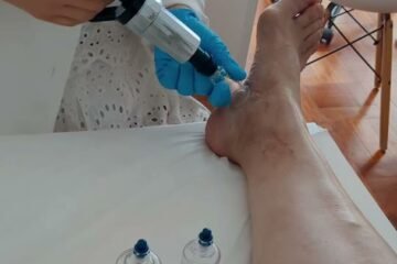 Yorrana Medeiros | Acupuntura em Lisboa-Clínica de Medicina Chinesa